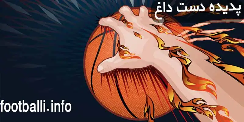 تشریح پدیده دست داغ
